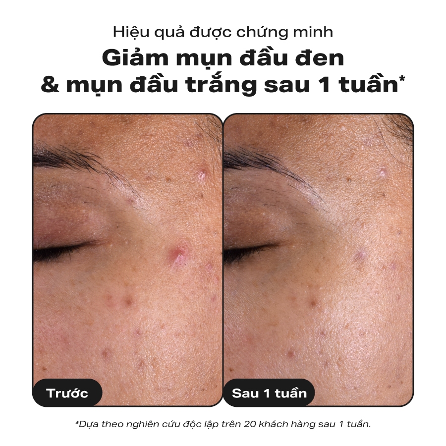 Paula's Choice 2% BHA