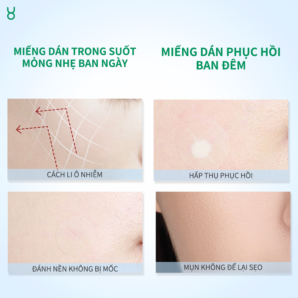Miếng Dán Mụn FOCALSKIN Day Night