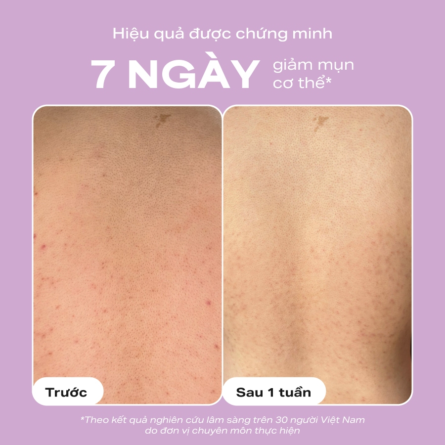 Paula's Choice 2% BHA Body Exfoliant