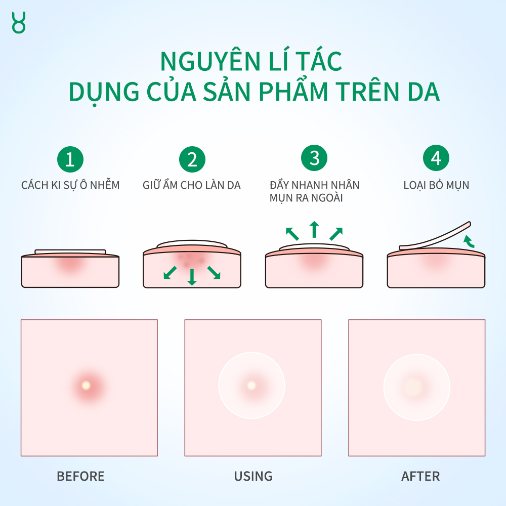 Miếng Dán Mụn FOCALSKIN Day Night