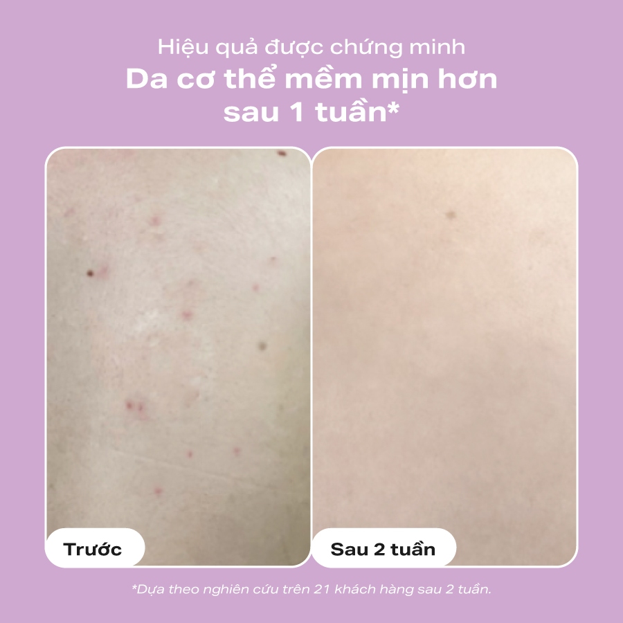 Paula's Choice 2% BHA Body Exfoliant