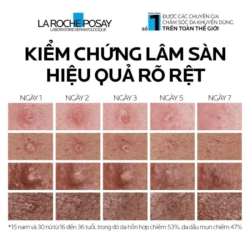 La Roche-Posay Effaclar Duo+M