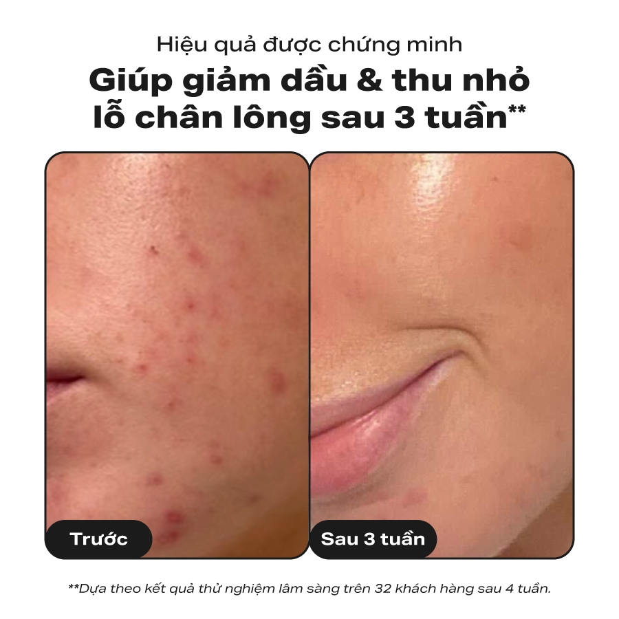 Paula's Choice 2% BHA