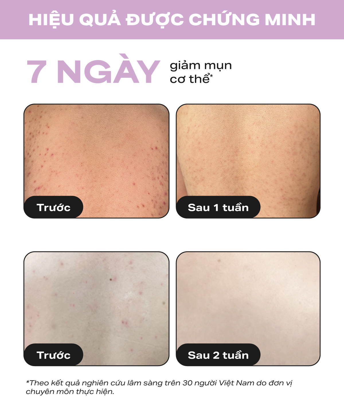 Paula's Choice 2% BHA Body Exfoliant