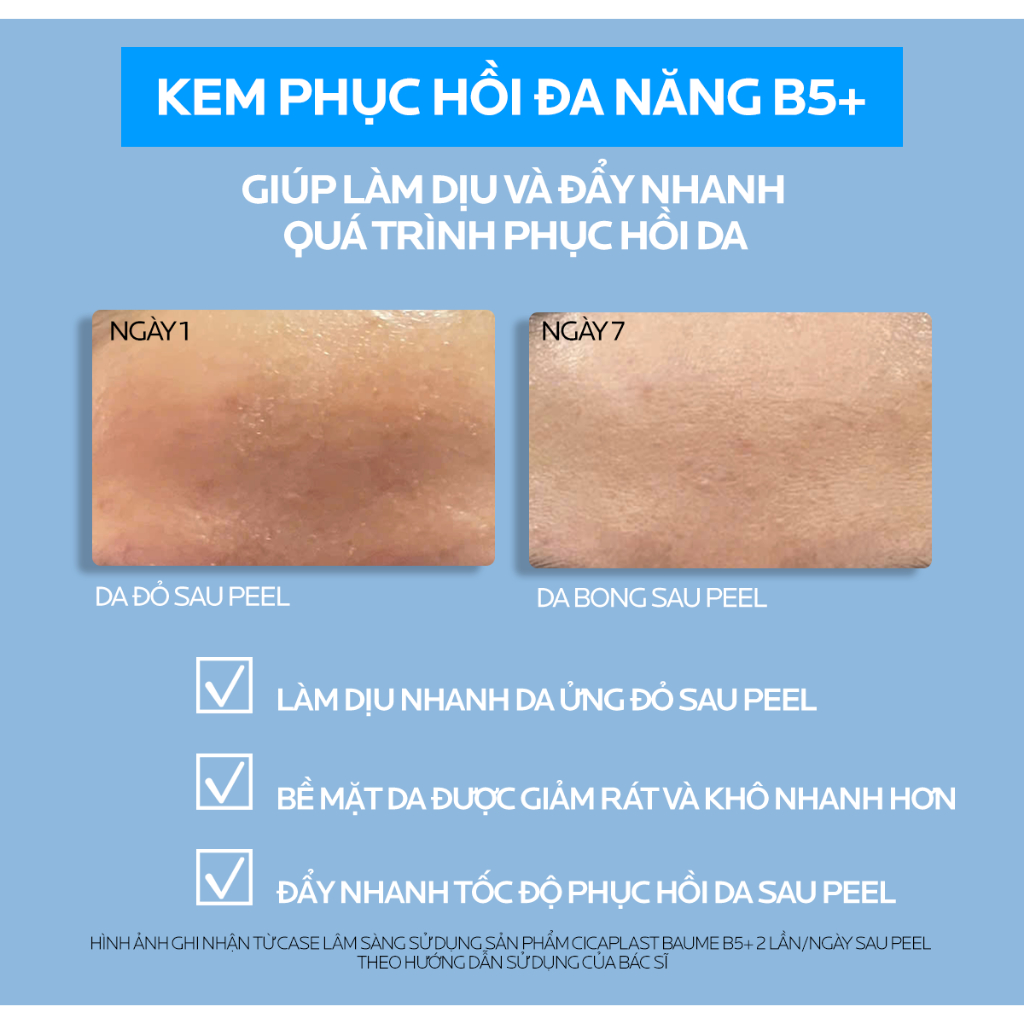 La Roche-Posay Cicaplast Baume B5+